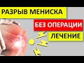 РАЗРЫВ МЕНИСКА лечение БЕЗ ОПЕРАЦИИ