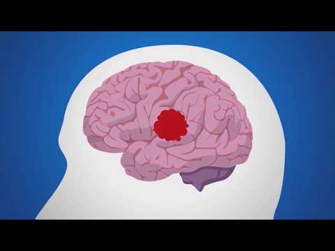 Vídeo: Com Restaurar El Sistema Nerviós Després De L'estrès