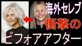 【衝撃】海外セレブの整形がヤバすぎる!!!まるで別人のように変わり果てた姿に・・・ メグライアン 検索動画37 【衝撃】海外セレブの整形がヤバすぎる!!!まるで別人のように変わり果てた姿に・・・ メグライアン 検索動画 37