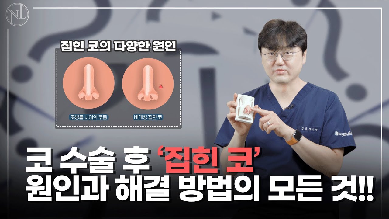 코성형 후 집힌 코의 원인과 해결 방법