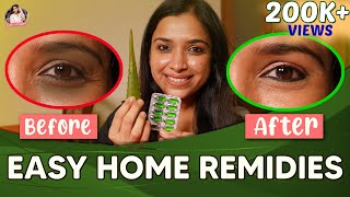 Easy Homecare Remedies For Skin Lightening | Dark Circles | Swetha Changappa