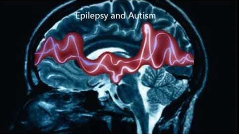 Brain Awareness Video Contest: Synesthesia