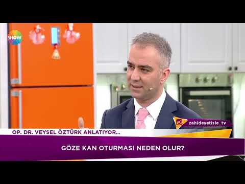 Göze kan oturması neden olur?