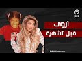 أروي اليمنية لجأت إلى عمليات التجميل 8 مراحل تغيرت فيها ملامح الفنانة أبرزها لون بشرتها وشكل أنفها