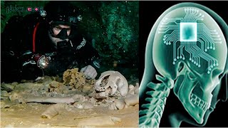 Des scientifiques découvrent un crâne vieux de 12 000 ans équipé d'une puce électronique