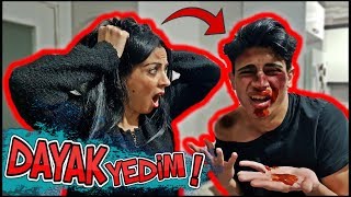 ANNE ME DAYAK YEDİM ŞAKASI ! (EFSANE KORKTU)