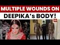 Greater Noida Dowry Case: Victim’s Body Shows Multiple Injuries, Murder Alleged | India Today