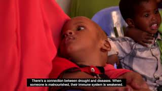 Drought and disease are leading top increased levels of malnutrition among children Somalia