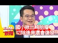 國小揪出畸胎瘤，切除後竟還會復發？！【醫師好辣】20200629 part4 EP970 陳木榮 米可白