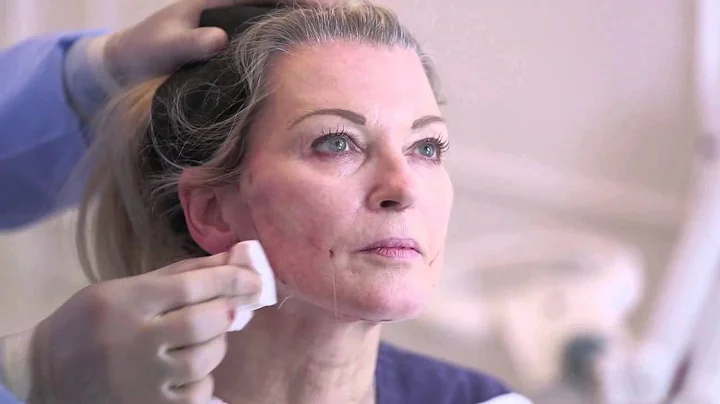 One Stitch Facelift SILHOUETTE SOFT GILLIAN TAYLFORTH