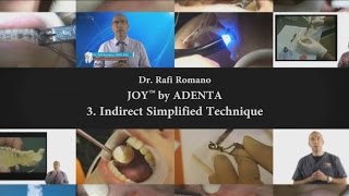 Dr. Rafi Romano - 3  JOY  indirect simplified technique