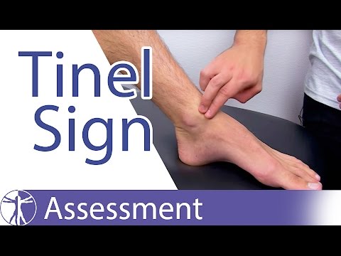 Tinel's Sign (Ankle)⎟Peripheral Nerve Injury