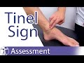 Tinel's Sign (Ankle)⎟Peripheral Nerve Injury