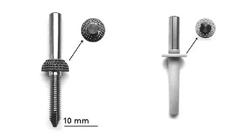 Intra osseous Transcutaneous Amputation Prosthesis ITAP ; provide direct skeletal attachment