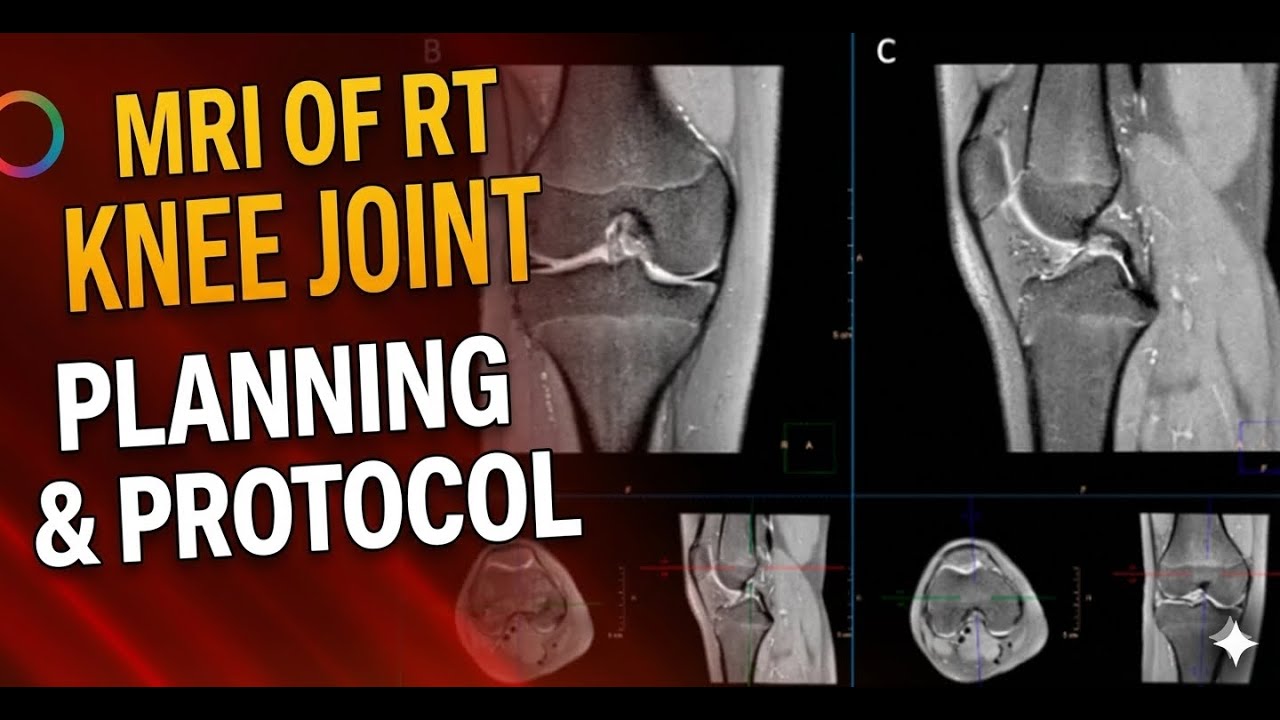 MRI of Right Knee Joint Planning | Positioning & Protocol Explained