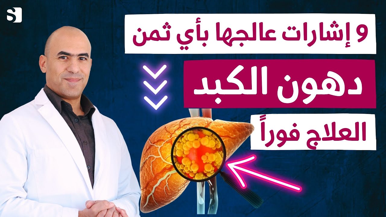 9 علامات من الكبد تجنبها باي ثمن | تخلص من دهون الكبد فورا بدون ادوية في اسبوع