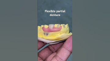 Flexible partial denture 😬😬😬#apexdental #splittooth #dentistry #partialdenture #orthodontist
