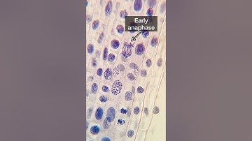 Chromosomes under the microscope