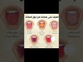 صحتك من لون لسانك هل تعلم صحتك اكسبلور لايك اشتراك دعم ترند خسارة الوزن تغذية 