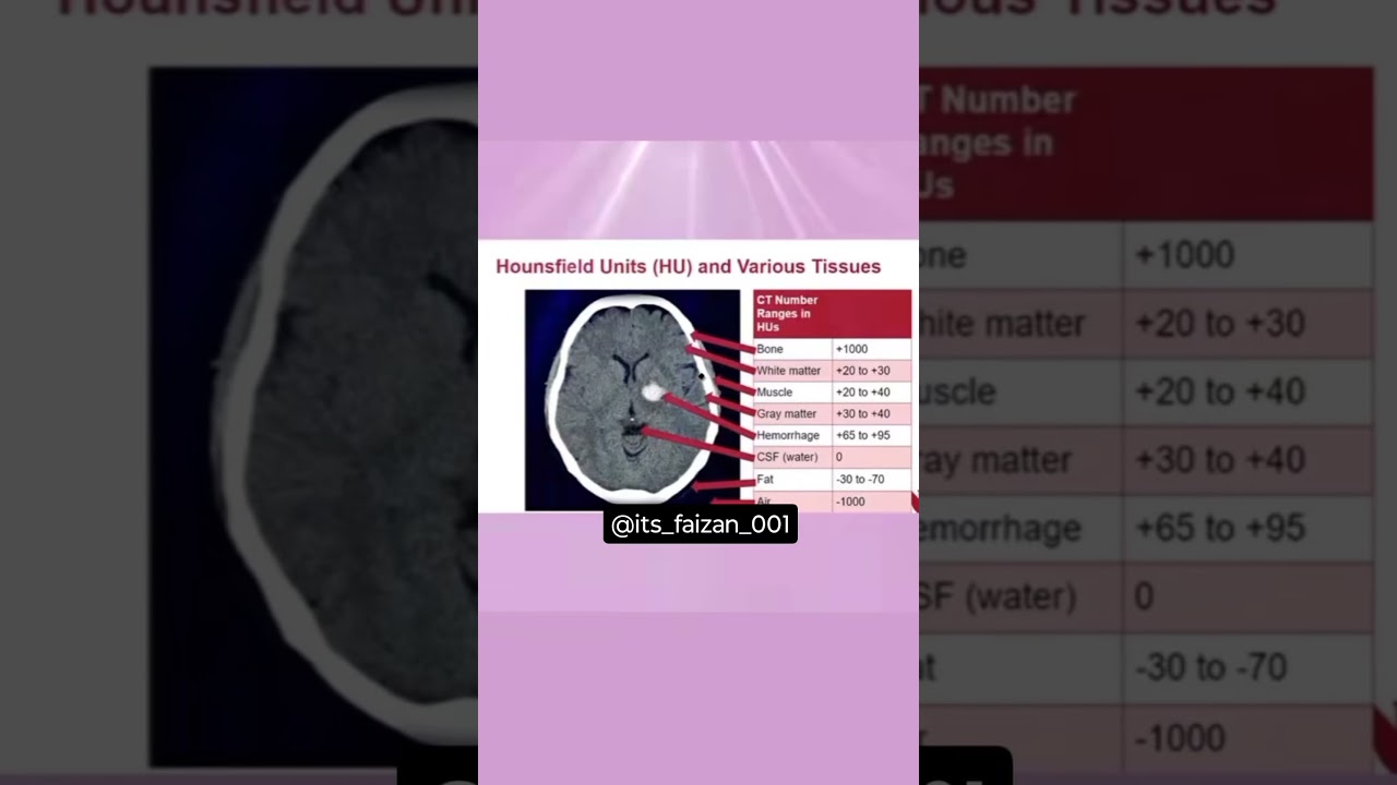 Hounsfield unit !!!
