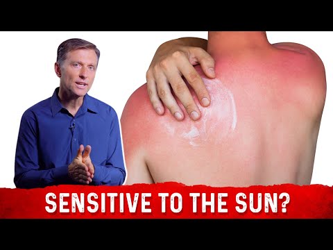 Sun-sensitive people need more than sunscreen to avoid sunburn