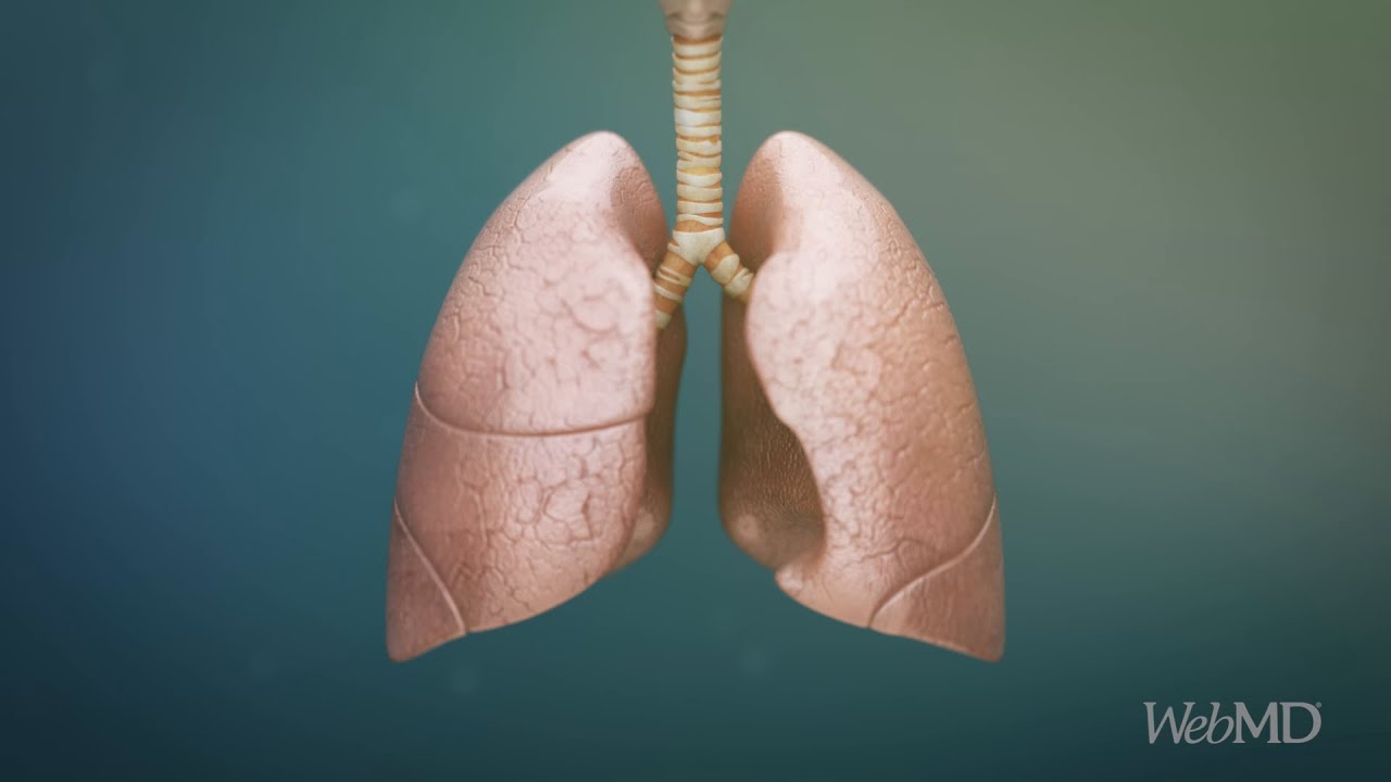 What COPD Does to Your Lungs WebMD YouTube