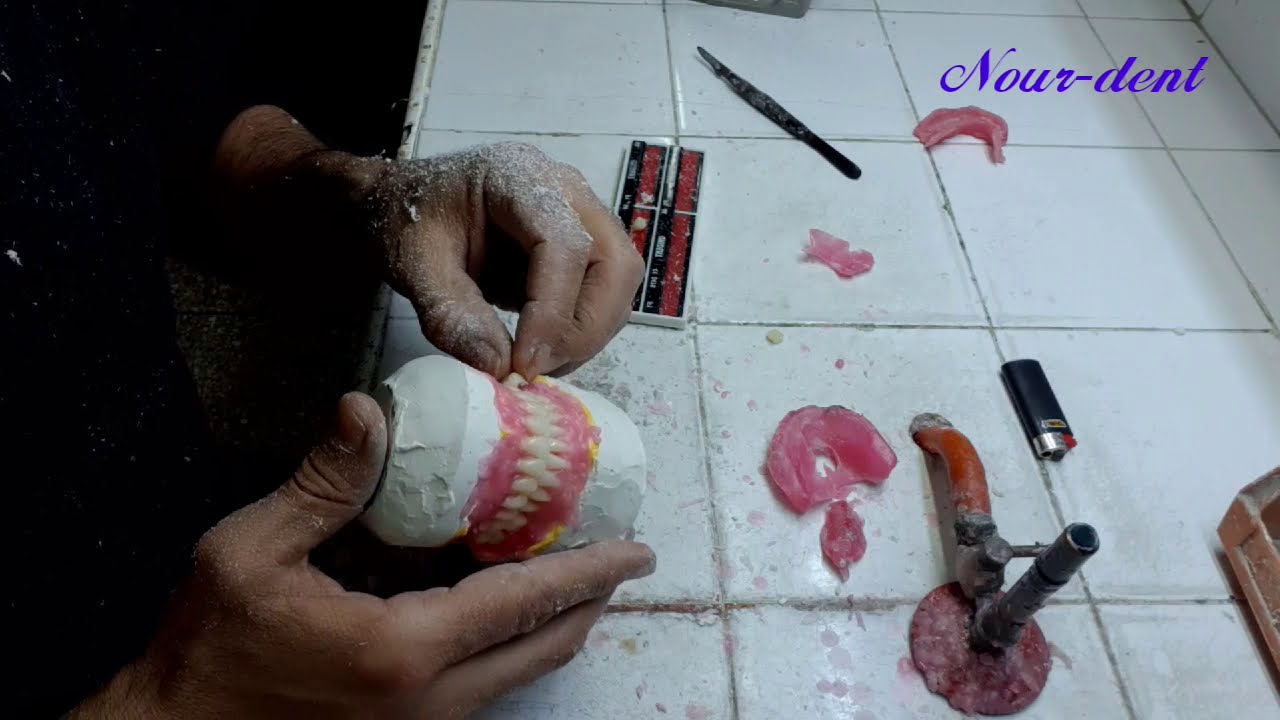 Montage d'un# total haut et bas (1ère partie).