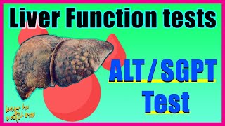 Alanine aminotransferase (ALT) test| SGPT| Alt test Results & Interpretation | Liver function test