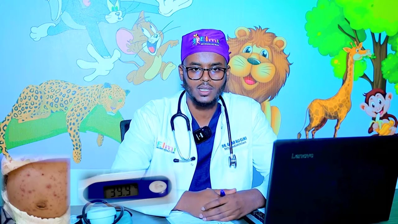 Xumada Caruurta Maxaa keena.?Dr Cumar Cali Cilmi