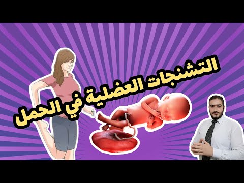 فيديو: هل التشنج يعني الحمل؟