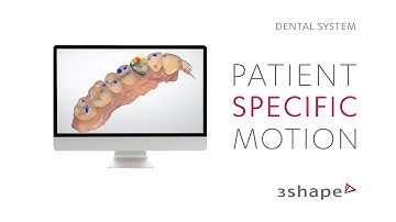 3Shape Dental System - How to use the patient specific motion in Dental System