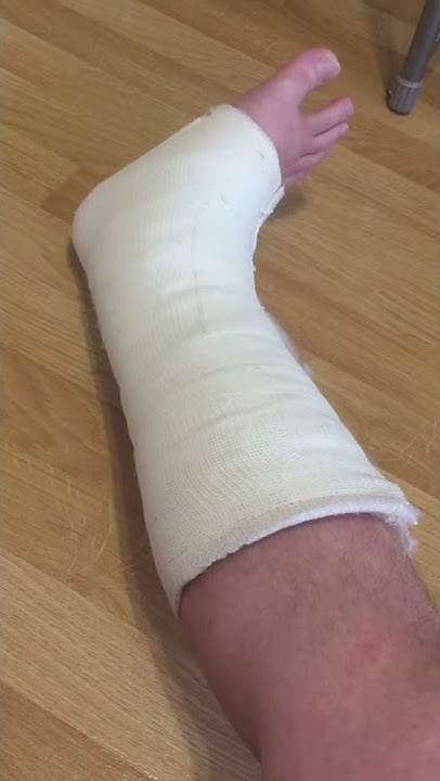 Bone disease - Osteoporosis, Osteomalacia, Avascular Necrosis Britannica