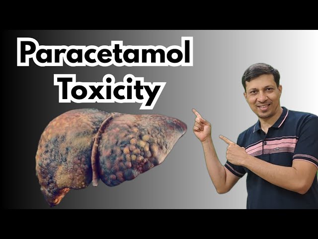 Paracetamol Toxicity Explained | Dose, Stages & Treatment | Must-Know for MBBS Students