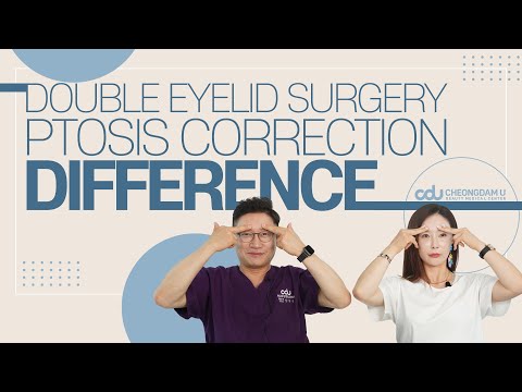 Video: Perbedaan Antara Ptosis Dan Blepharoplasty