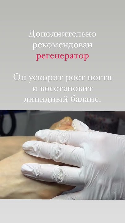 Отошел ноготь от кожи, восстановление ногтей - YouTube
