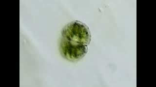 Cosmarium sp. under the microscope