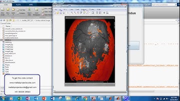 RETINAL BLOOD VESSEL SEGMENTATION FROM FUNDUS IMAGE