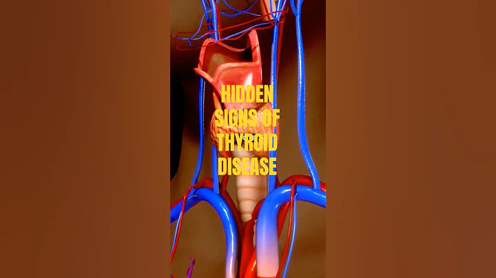 Thyroid Disease Signs And Symptoms #hypothyroidism #thyroid #shorts