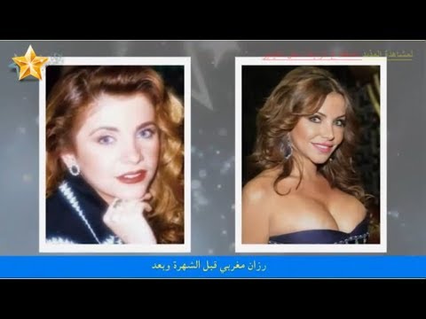 شاهد رزان مغربي قبل الشهرة وعمليات التجميل