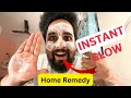 Instant glowing face home remedy  dr niranjan samani