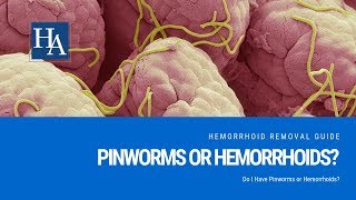 pinworms viszketés kezelése