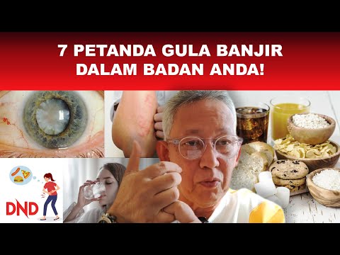 Video: Bolehkah anda memberi makan berlebihan kepada jururawat?