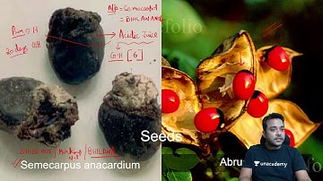 INI-CET | High yield Forensic MCQs | Dr. Vishwajeet Singh