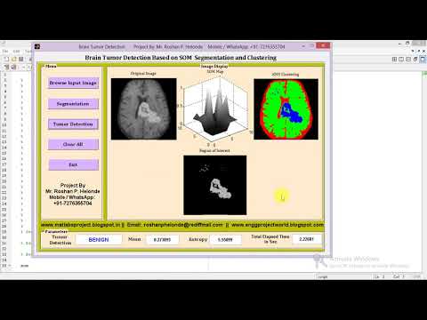 Brain Tumor Detection using Segmentation & Clustering matlab project code