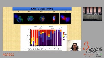 SABCS 2021: Single cell analysis of circulating tumor cells