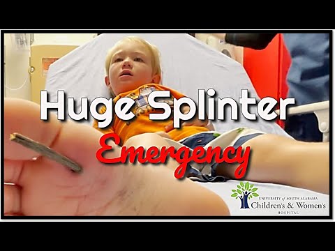 Huge Splinter Stuck in Toddler's Foot