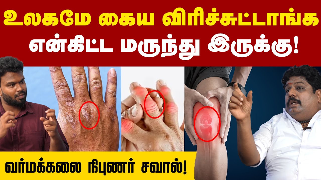 Arthritis: முடக்குவாதம் வர்மக்கலை மூலம் சரி பண்றேன் | Positivitea | Varmakalai