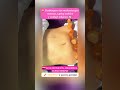 🪵ABDOMEN DEFINIDO CON MADERA #belleza #mederoterapia #woodtherapy #drenajelinfatico #estetica #fyp