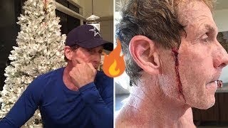 Skip Bayless Cuts His Face after Cowboys loss to Colts | Undisputed