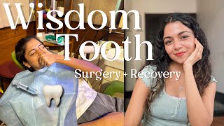 Wisdom tooth removal surgery + recovery and sharing my experience | Hansika Krishna screenshot 3